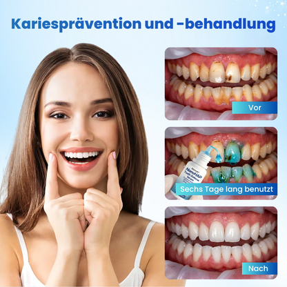 Biancat® EnaMend Nano-Fusion Zahnschutz-Serum