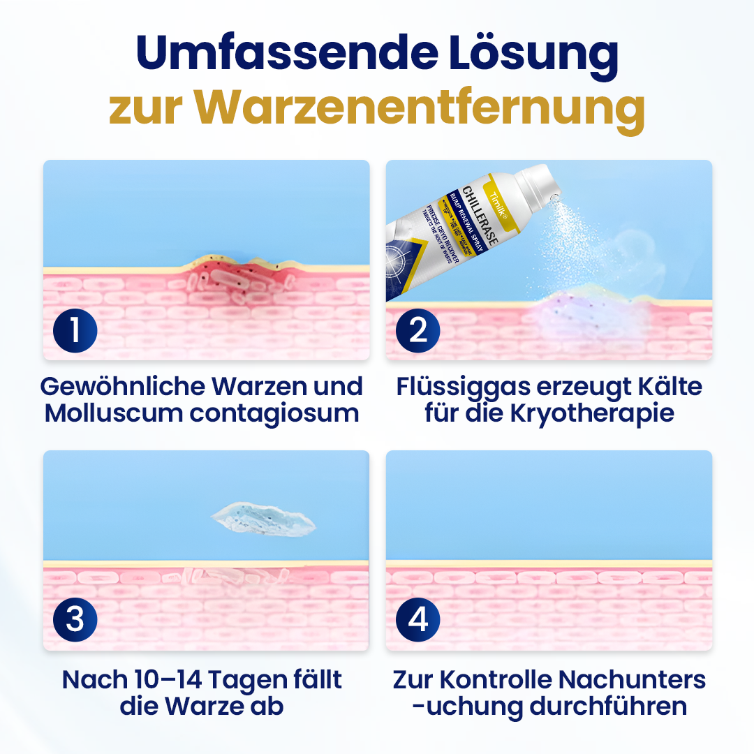 Timilk® ChillErase Erneuerungs-Spray gegen Hautunr ❤️