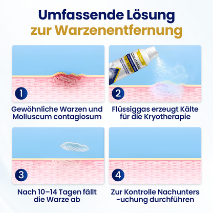Timilk® ChillErase Erneuerungs-Spray gegen Hautunr ❤️