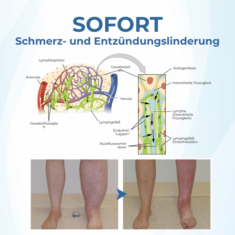 Timilk® TheraVein Kräuter-Spray gegen Krampfadern