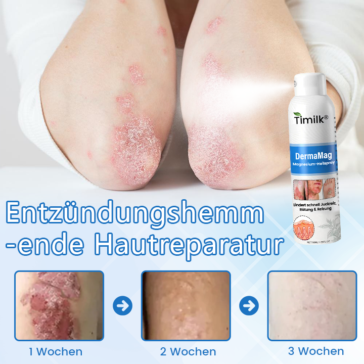 ✅ Offizieller Shop: Timilk® DermaMag Magnesium-Reparaturspray 🔥