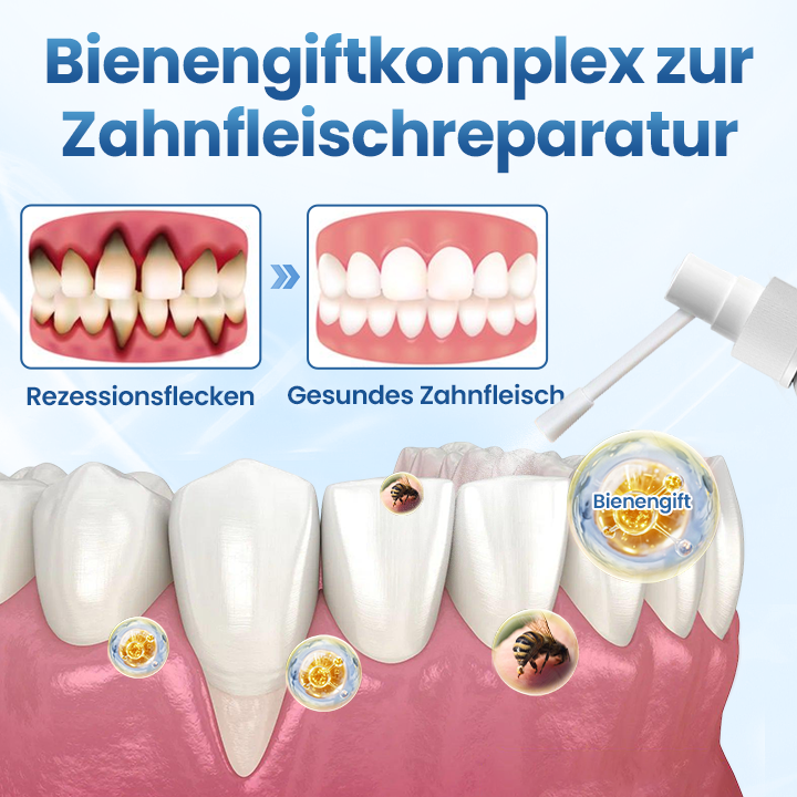 Timilk® GumRelief Natürliches Spray🔥