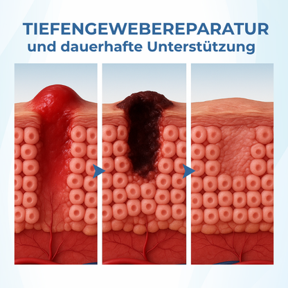 Timilk® TheraVein Kräuter-Spray gegen Krampfadern