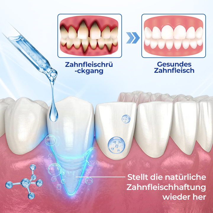 Biancat® BeeTakt Zahnfleisch-Repair Lösung