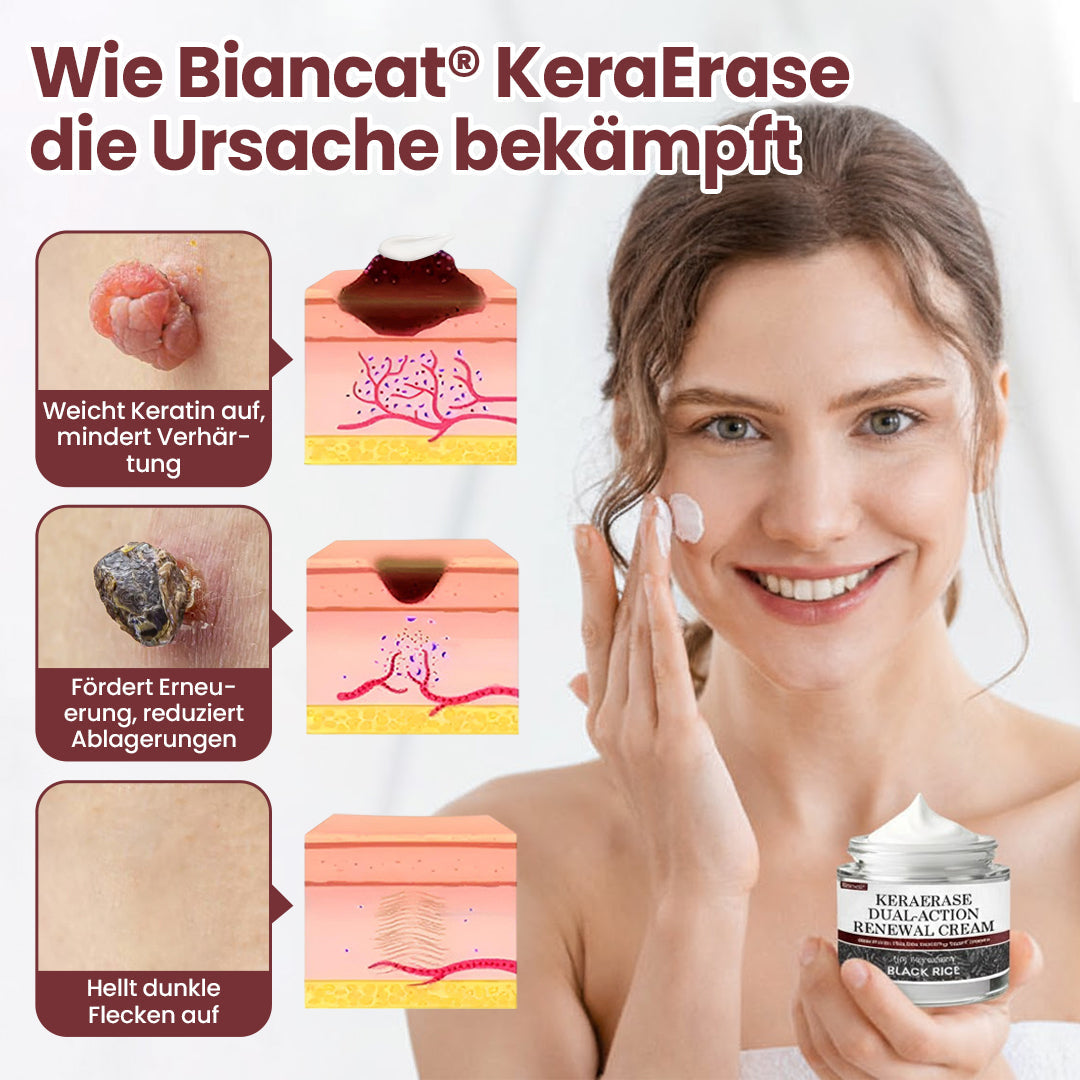 Biancat® KeraErase Dual-Action Erneuerungscreme