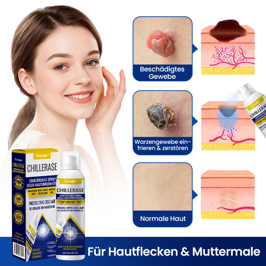 Timilk® ChillErase Erneuerungs-Spray gegen Hautunr ❤️