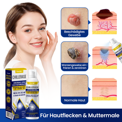 Timilk® ChillErase Erneuerungs-Spray gegen Hautunr ❤️