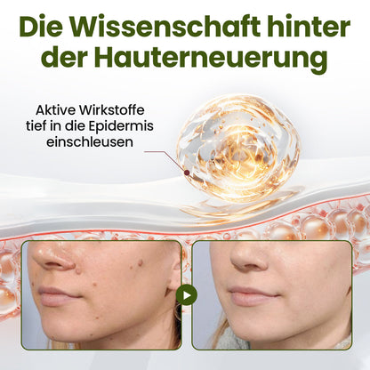 Biancat® MagneErase Erneuerungscreme