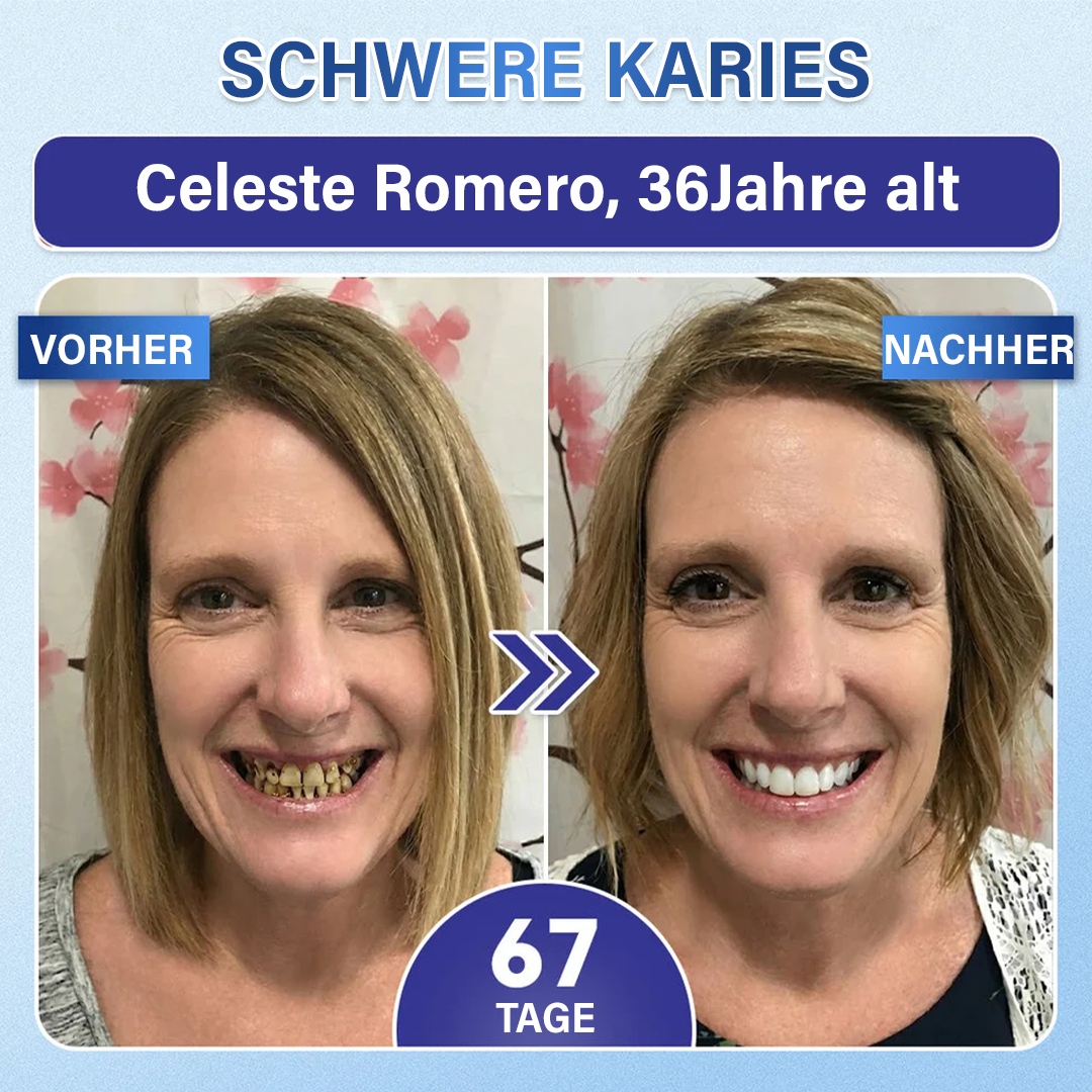 (NEW)Ceoerty® Zahn- und Zahnfleischpflege – schnell lösliches Mikronadel-Pflaster✨ (𝟓-𝐢𝐧-𝟏 💎 𝐙𝐚𝐡𝐧𝐬𝐜𝐡𝐦𝐞𝐥𝐳 & 𝐃𝐞𝐧𝐭𝐢𝐧 𝐖𝐢𝐞𝐝𝐞𝐫𝐚𝐮𝐟𝐛𝐚𝐮𝐞𝐧 • 𝐙𝐚𝐡𝐧𝐟𝐥𝐞𝐢𝐬𝐜𝐡 𝐒𝐭ä𝐫𝐤𝐞𝐧 • 𝐙𝐚𝐡𝐧𝐬𝐭𝐞𝐢𝐧 & 𝐌𝐮𝐧𝐝𝐠𝐞𝐫𝐮𝐜𝐡 𝐁𝐞𝐬𝐞𝐢𝐭𝐢𝐠𝐞𝐧 • 𝐙ä𝐡𝐧𝐞 𝐀𝐮𝐟𝐡𝐞𝐥𝐥𝐞𝐧 • 𝐙𝐚𝐡𝐧𝐞𝐦𝐩𝐟𝐢𝐧𝐝𝐥𝐢𝐜𝐡𝐤𝐞𝐢𝐭 𝐒𝐭𝐨𝐩𝐩𝐞𝐧)