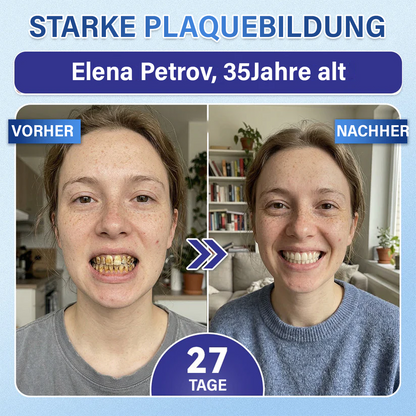 (NEW)Ceoerty® Zahn- und Zahnfleischpflege – schnell lösliches Mikronadel-Pflaster✨ (𝟓-𝐢𝐧-𝟏 💎 𝐙𝐚𝐡𝐧𝐬𝐜𝐡𝐦𝐞𝐥𝐳 & 𝐃𝐞𝐧𝐭𝐢𝐧 𝐖𝐢𝐞𝐝𝐞𝐫𝐚𝐮𝐟𝐛𝐚𝐮𝐞𝐧 • 𝐙𝐚𝐡𝐧𝐟𝐥𝐞𝐢𝐬𝐜𝐡 𝐒𝐭ä𝐫𝐤𝐞𝐧 • 𝐙𝐚𝐡𝐧𝐬𝐭𝐞𝐢𝐧 & 𝐌𝐮𝐧𝐝𝐠𝐞𝐫𝐮𝐜𝐡 𝐁𝐞𝐬𝐞𝐢𝐭𝐢𝐠𝐞𝐧 • 𝐙ä𝐡𝐧𝐞 𝐀𝐮𝐟𝐡𝐞𝐥𝐥𝐞𝐧 • 𝐙𝐚𝐡𝐧𝐞𝐦𝐩𝐟𝐢𝐧𝐝𝐥𝐢𝐜𝐡𝐤𝐞𝐢𝐭 𝐒𝐭𝐨𝐩𝐩𝐞𝐧)