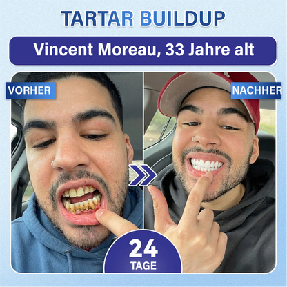 (NEW)Ceoerty® Zahn- und Zahnfleischpflege – schnell lösliches Mikronadel-Pflaster✨ (𝟓-𝐢𝐧-𝟏 💎 𝐙𝐚𝐡𝐧𝐬𝐜𝐡𝐦𝐞𝐥𝐳 & 𝐃𝐞𝐧𝐭𝐢𝐧 𝐖𝐢𝐞𝐝𝐞𝐫𝐚𝐮𝐟𝐛𝐚𝐮𝐞𝐧 • 𝐙𝐚𝐡𝐧𝐟𝐥𝐞𝐢𝐬𝐜𝐡 𝐒𝐭ä𝐫𝐤𝐞𝐧 • 𝐙𝐚𝐡𝐧𝐬𝐭𝐞𝐢𝐧 & 𝐌𝐮𝐧𝐝𝐠𝐞𝐫𝐮𝐜𝐡 𝐁𝐞𝐬𝐞𝐢𝐭𝐢𝐠𝐞𝐧 • 𝐙ä𝐡𝐧𝐞 𝐀𝐮𝐟𝐡𝐞𝐥𝐥𝐞𝐧 • 𝐙𝐚𝐡𝐧𝐞𝐦𝐩𝐟𝐢𝐧𝐝𝐥𝐢𝐜𝐡𝐤𝐞𝐢𝐭 𝐒𝐭𝐨𝐩𝐩𝐞𝐧)