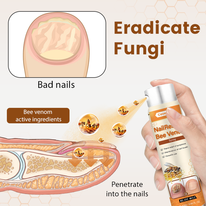 Ceoerty® NailRescue Bienengift-Spray