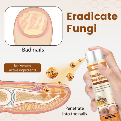 Ceoerty® NailRescue Bienengift-Spray