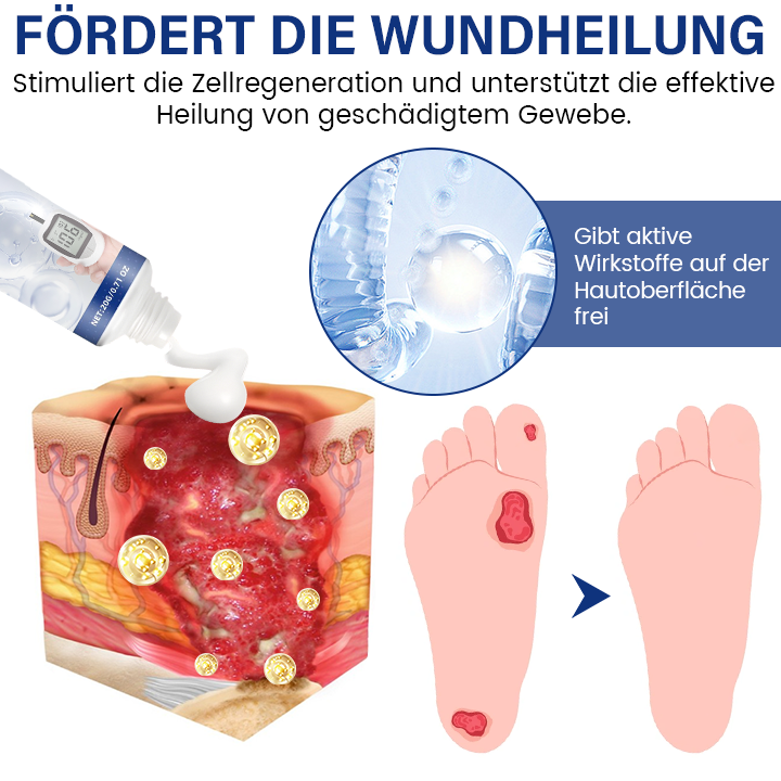 Timilk® SugarRelief Creme zur Behandlung von Diabetes