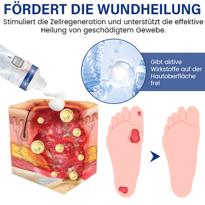 Timilk® SugarRelief Creme zur Behandlung von Diabetes
