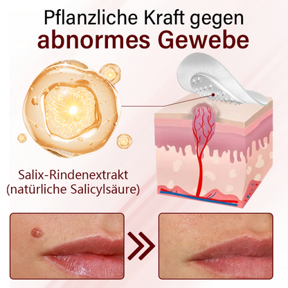 Timilk® Vionara Nano Warzenentfernungs-Pflaster🔥