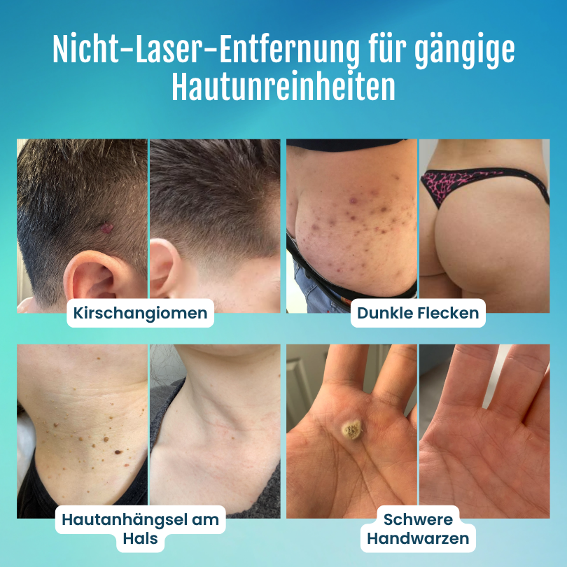 Timilk® SpotlessPro Advanced Hautpflege-Stift