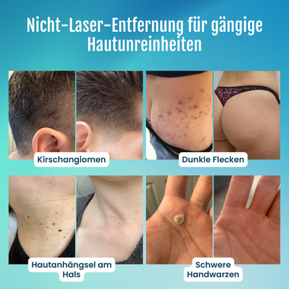 Timilk® SpotlessPro Advanced Hautpflege-Stift