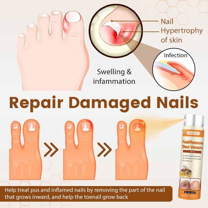 Ceoerty® NailRescue Bienengift-Spray