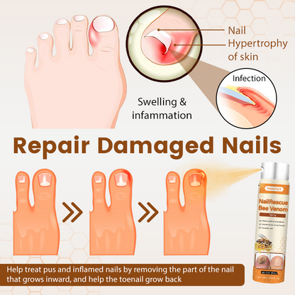 Ceoerty® NailRescue Bienengift-Spray
