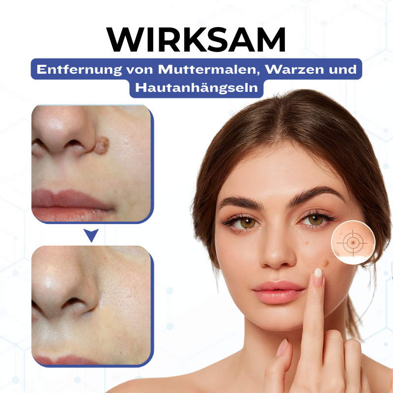 Timilk® VanishPro Hautflecken-Entfernungscreme