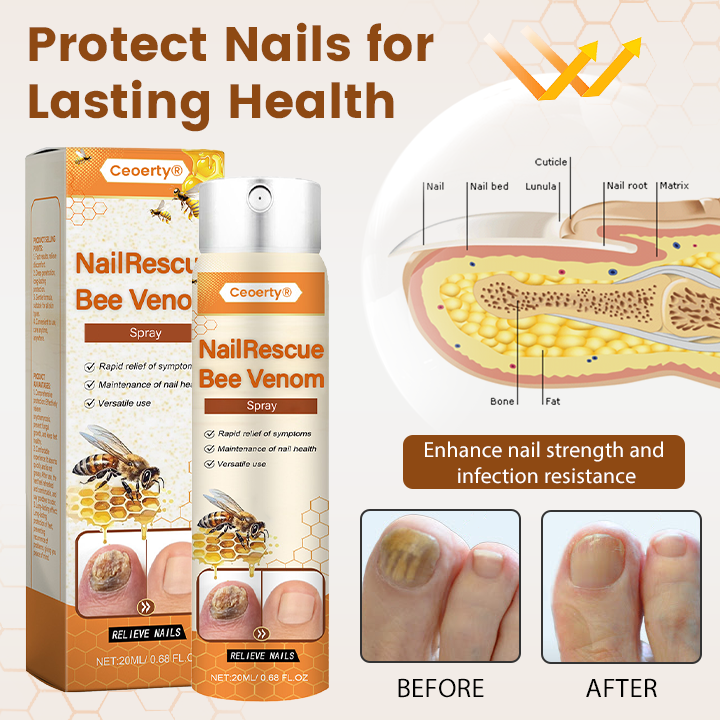 Ceoerty® NailRescue Bienengift-Spray