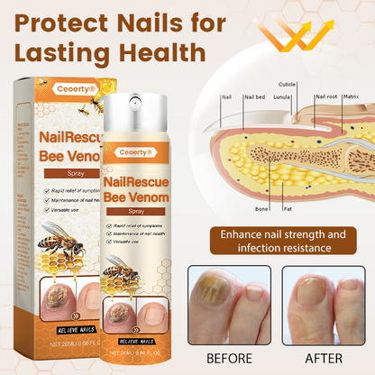 Ceoerty® NailRescue Bienengift-Spray