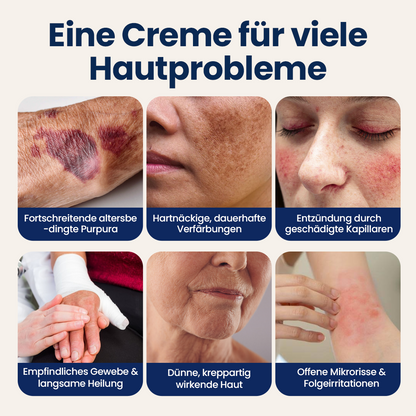 Biancat® ResiliVeil Barriere-Pflegecreme gegen blaue Flecken❤️