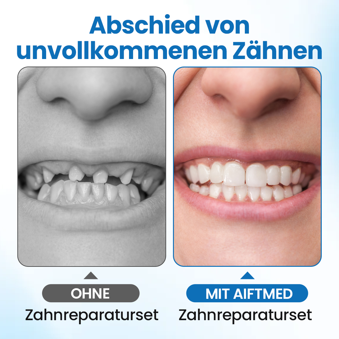 Timilk® SmileMend Zahnreparatur-Füllungsset🔥