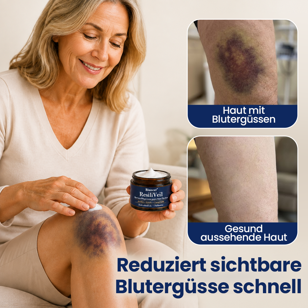 Biancat® ResiliVeil Barriere-Pflegecreme gegen blaue Flecken❤️