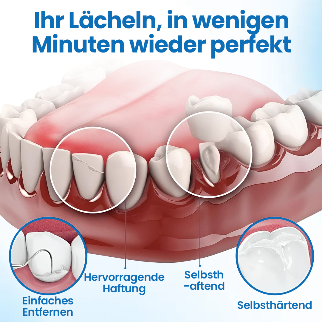 Timilk® SmileMend Zahnreparatur-Füllungsset🔥