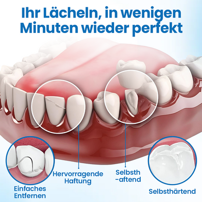 Timilk® SmileMend Zahnreparatur-Füllungsset🔥