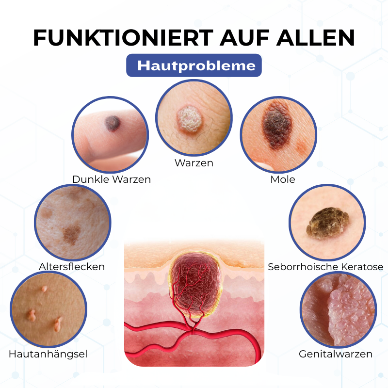 Timilk® VanishPro Hautflecken-Entfernungscreme