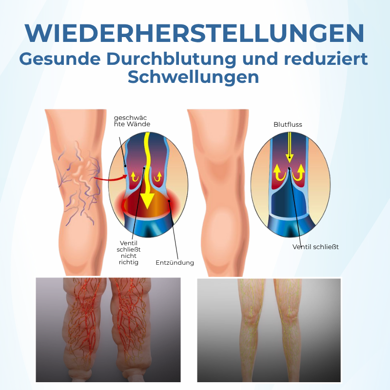 Timilk® TheraVein Kräuter-Spray gegen Krampfadern