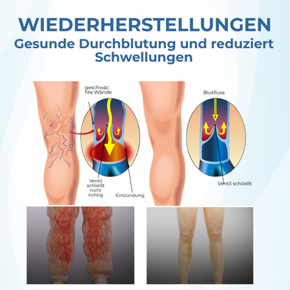 Timilk® TheraVein Kräuter-Spray gegen Krampfadern